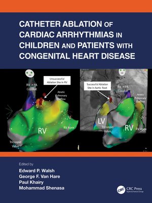 cover image of Catheter Ablation of Cardiac Arrhythmias in Children and Patients with Congenital Heart Disease